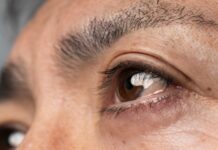 Можливий зв’язок між дальтонізмом і гіршими наслідками при раку сечового міхура