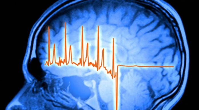 Розкрито роль мозку у відновленні після серцевого нападу