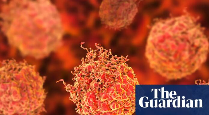 Прорив в Імунотерапії Виявляє Багатообіцяючі Результати при Просунутому Раку Простати