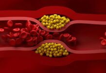 Оновлені рекомендації щодо холестерину: попереджувальна профілактика для кращого здоров’я серця