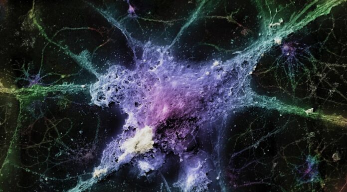 Націлюючись на «систему утилізації відходів» мозку: нові горизонти у дослідженні хвороби Альцгеймера