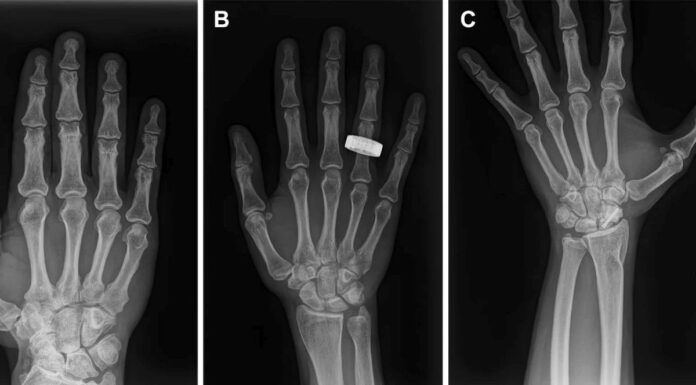 First human X-rays in space actually worked